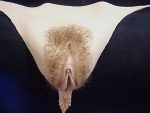Vagina Prosthesis